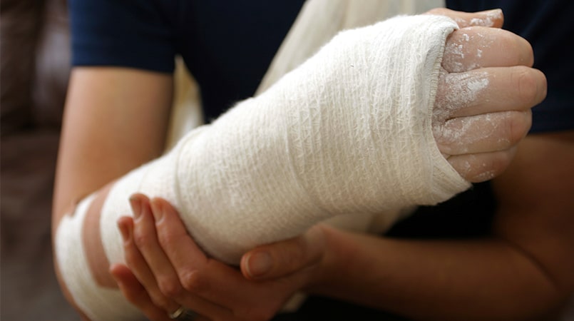 Arm Injury